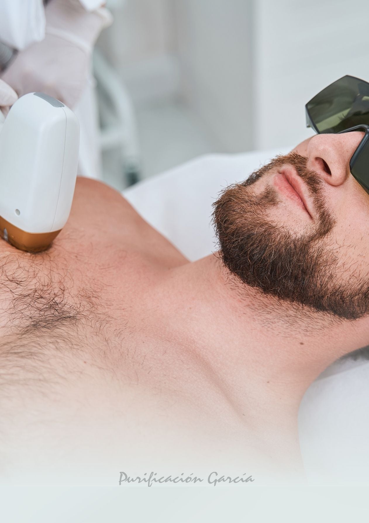 Depilación Láser Masculina