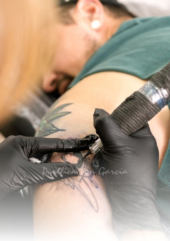 Borrado Tatuajes